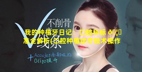 我的种植牙日记：口腔科标 🦆 准全解析(口腔种植诊疗技术操作规范和诊疗指南)